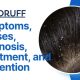 Dandruff: Symptoms, Causes, Diagnosis, Treatment, and Prevention